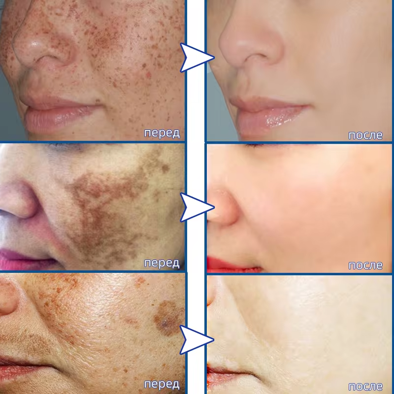 Powerful Spot-removing Whiteni - Korean Skincare Routine ulasan dan harga