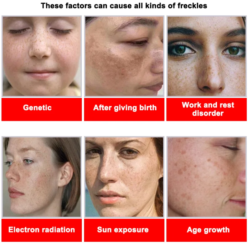 Powerful Spot-removing Whiteni - Korean Skincare Routine ulasan dan harga