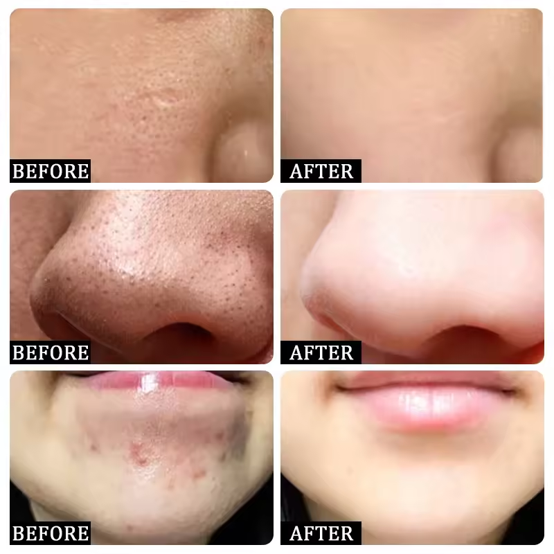 Pore Shrinking Cream Eliminati - Korean Skincare Routine ulasan dan harga