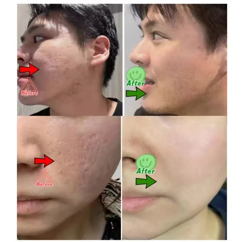 Pore Shrinking Cream Eliminati - Korean Skincare Routine ulasan dan harga