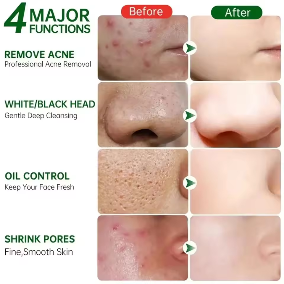 Pore Shrinking Cream Eliminati - Korean Skincare Routine ulasan dan harga